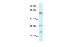 VSIG10 Rabbit anti-Human, Polyclonal, Novus Biologicals 0.1ml; Unconjugated:Antibodies,